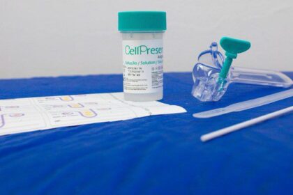 Teste DNA-HPV, disponível no SUS. — Foto: João Risi/Ministério da Saúde