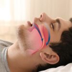 Apneia do sono: 7 fatos que você precisa saber sobre o distúrbio que afeta milhões de brasileiros