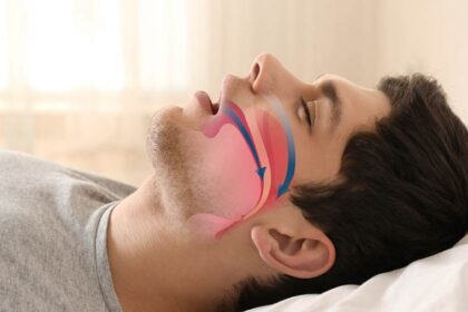 Apneia do sono: 7 fatos que você precisa saber sobre o distúrbio que afeta milhões de brasileiros
